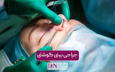جراحی بینی گوشتی