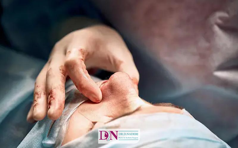 هزینه جراحی بینی گوشتی در سال 1404 چقدر است؟