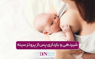 شیردهی و بارداری بعد از پروتز سینه