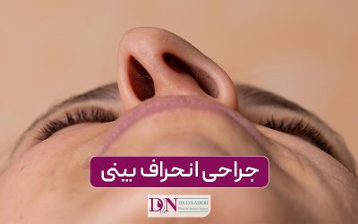 جراحی انحراف بینی