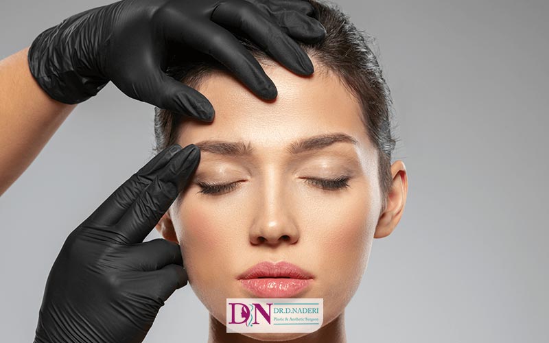 لیفت گوشه چشم و شقیقه با نخ