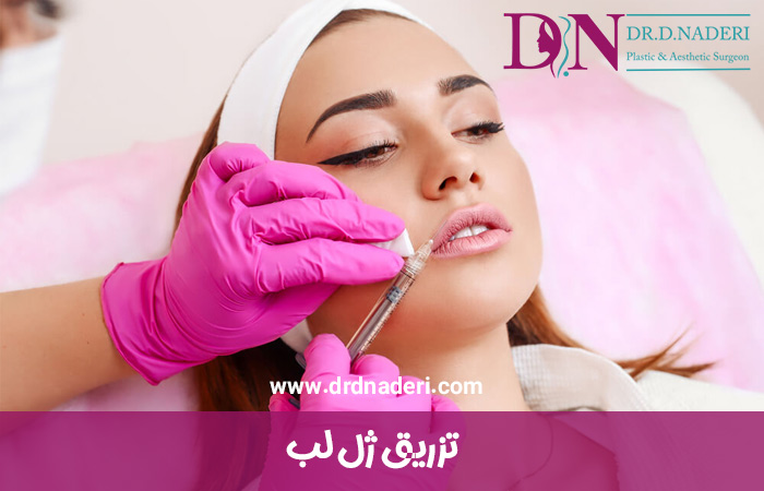 تزریق-ژل-لب