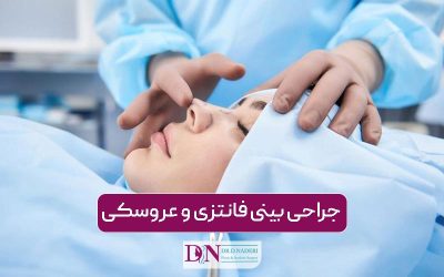 جراحی بینی فانتزی | راهنمای کامل همراه با ویدئو و نمونه کار واقعی