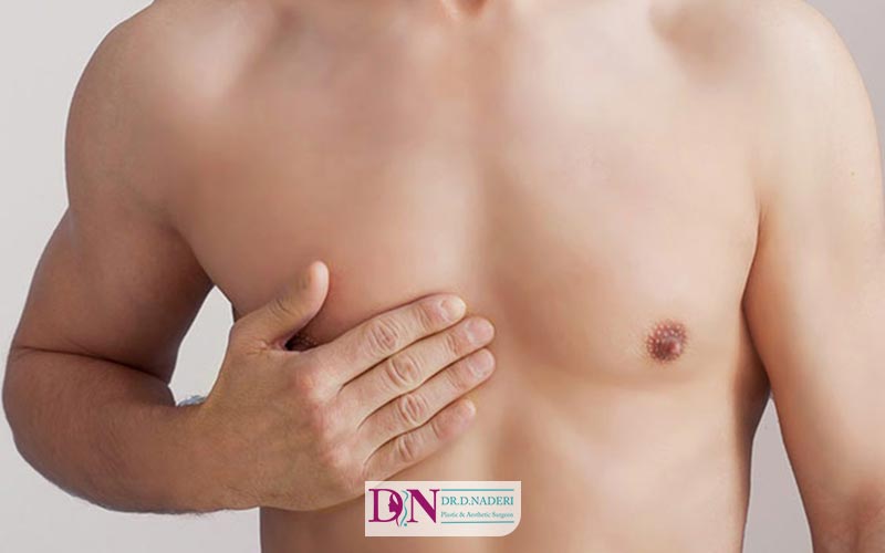 عوامل ثائیر گذار بر قیمت عمل جراحی ژنیکوماستی آقایان
