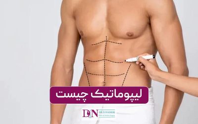لیپوماتیک | رازهای ناگفته + ویدئوهای اتاق عمل و نمونه کار
