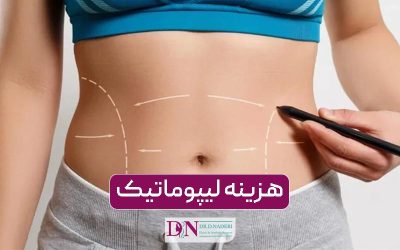 هزینه لیپوماتیک در سال ۱۴۰۴ چقدر است؟