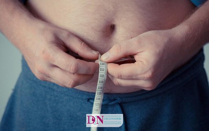 آیا بیمه هزینه لیپوماتیک شکم را پرداخت میکند؟