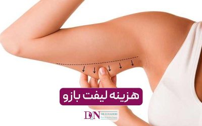 هزینه جراحی لیفت بازو در سال ۱۴۰۴