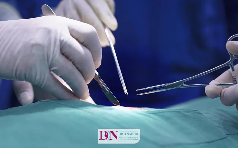 سوابق علمی جراح یکی از ویژگی های بهترین دکتر عمل بینی استخوانی است