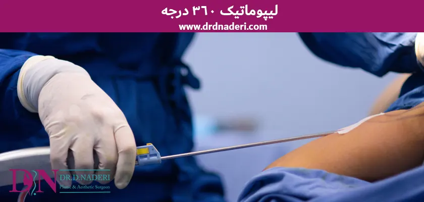 لیپوماتیک 360 درجه لیپوماتیک 360 درجه