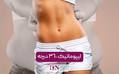لیپوماتیک 360 درجه؛ تحولی شگفتانگیز در تناسباندام