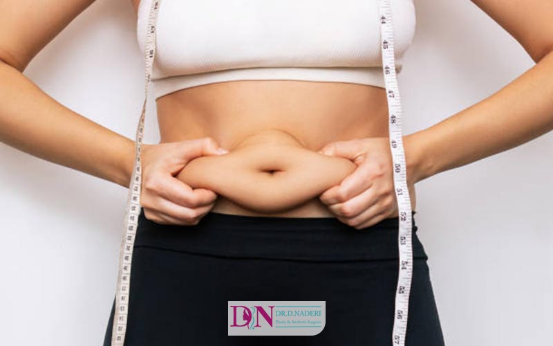 هزینه لیپوماتیک چقدر است؟ قیمت عمل جراحی لیپو در سال 1404
