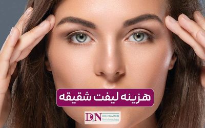 هزینه لیفت شقیقه