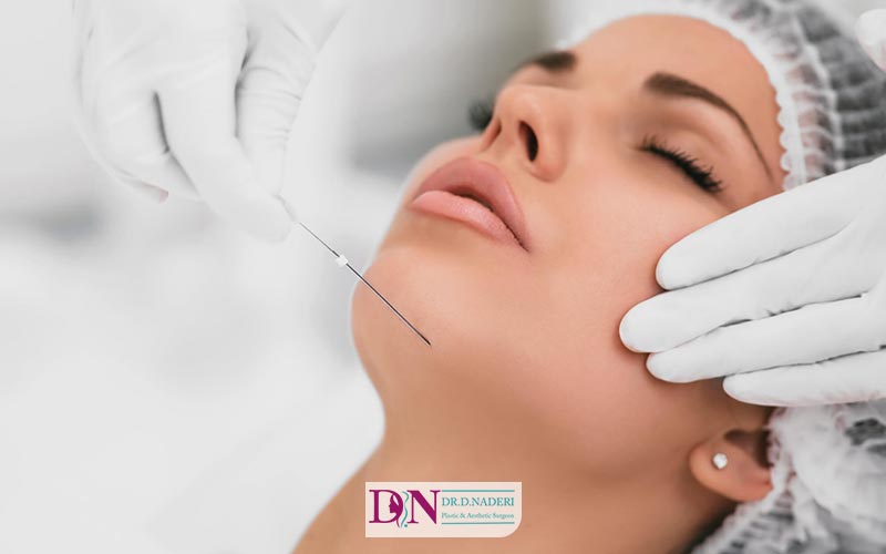 نخ خاردار یا کاگ چیست و چه کاربردی در لیفت صورت با نخ دارد؟