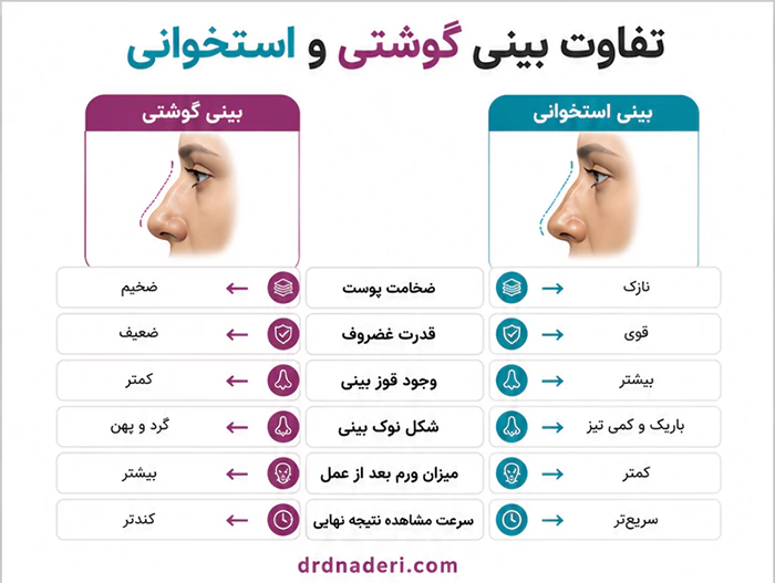تفاوت گوشتی و استخوانی