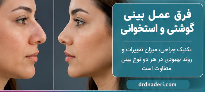 فرق بینی گوشتی و استخوانی