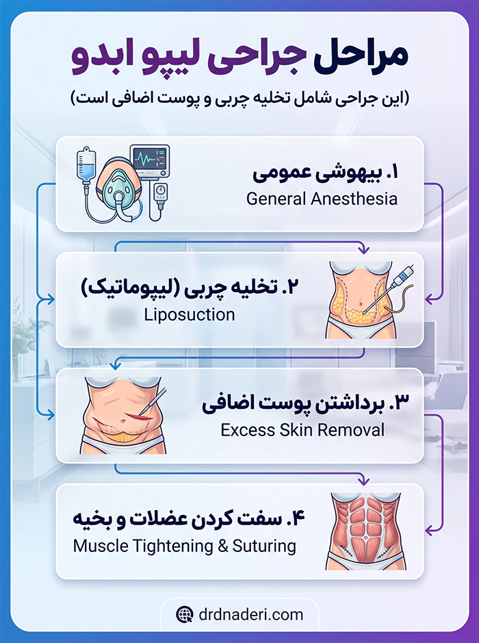 اینفوگرافیک از مراحل عمل لیپو ابدو